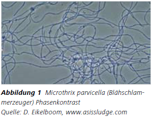 Abbildung 1 Microthrix parvicella (Blähschlammerzeuger) Phasenkontrast
Quelle: D. Eikelboom, www.asissludge.com